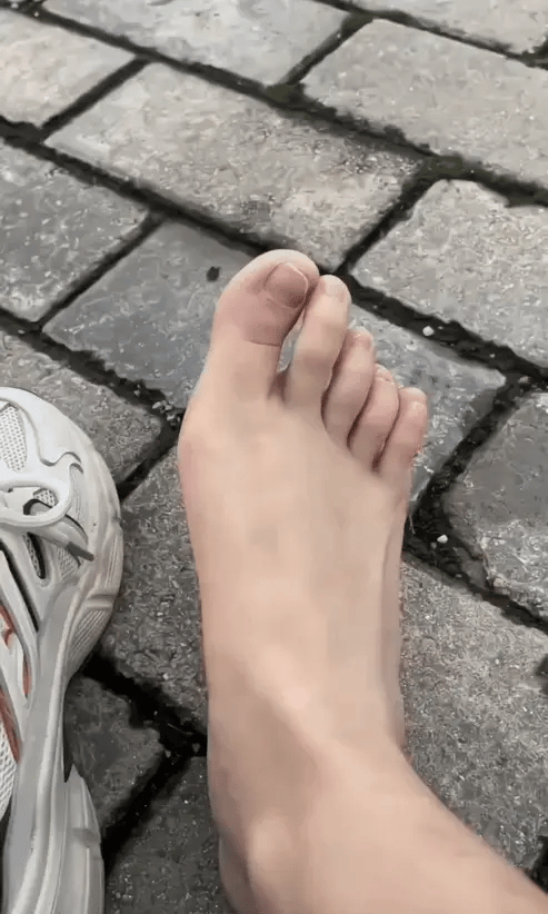 "Profoot Bunion Corrector – Soothing Overnight Support & Alignment"